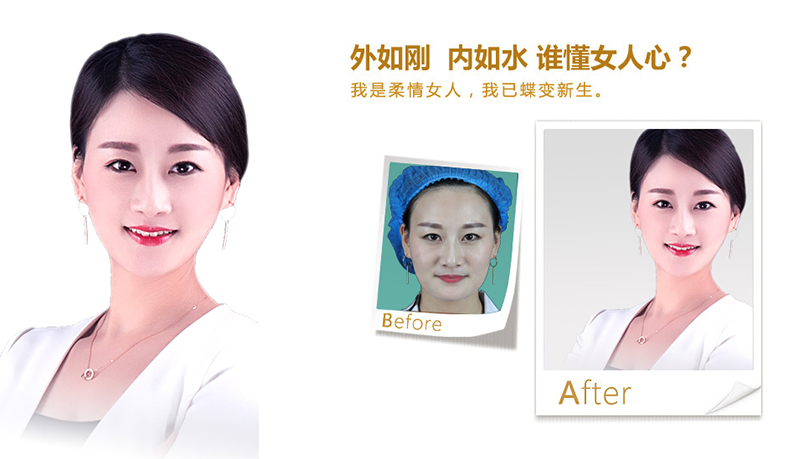 烟台V脸、线雕隆鼻